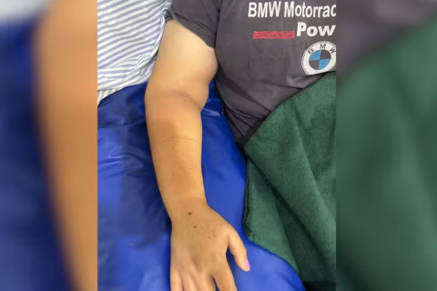 Mulher é picada por cobra jararaca enquanto colhia abóboras em sítio no interior de SP