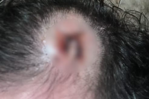 Personal trainer desmaia após ser golpeado na cabeça com peso de academia por aluno no interior de SP